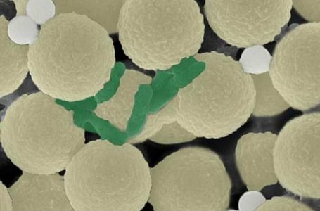Para limpiar el agua, los investigadores diseñaron enjambres de diminutos robots esféricos (amarillo claro) que recogen bacterias (verde) y pequeñas piezas de plástico (gris). (Imagen: adaptada de ACS Nano 2024, DOI: 10.1021/acsnano.4c02115. CC BY)

